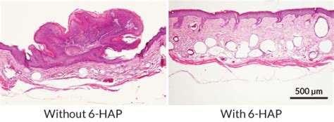 Human skin bacteria might protect against skin cancer, scientists say