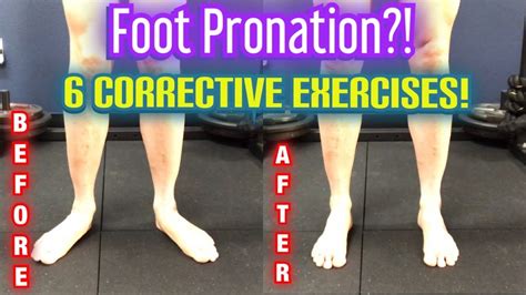 Overpronation Exercises