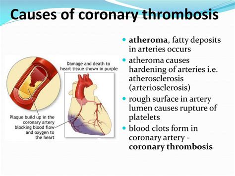 Coronary Artery Disease: Causes, Symptoms, and Prevention Strategies