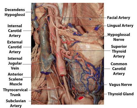 Carotid Endarterectomy | The Neurosurgical Atlas