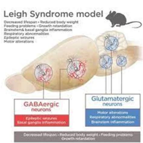 Leigh Syndrome treatment in Homeopathy, Homoeopathic World | ID ...