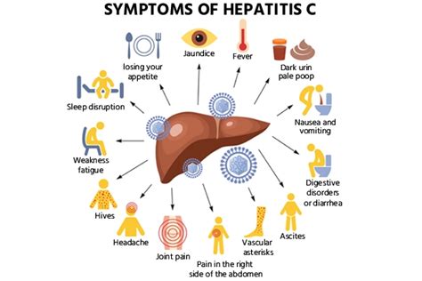 Hepatitis C: Causes, Symptoms, Treatment & Diagnosis