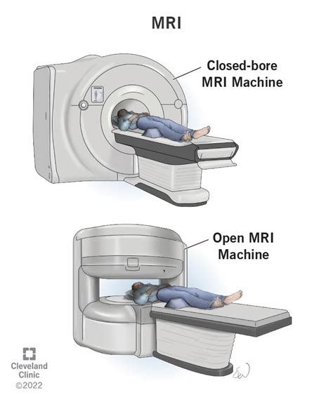 Brain Mri Scan Machine