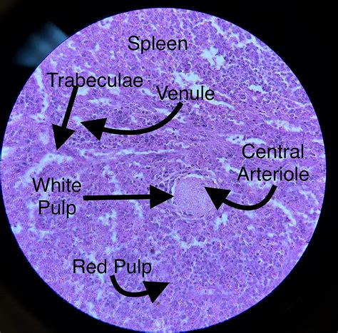 Spleen Histology.