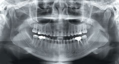 3D Cone Beam Computed Tomography (CBCT) · Broadway Family Dental