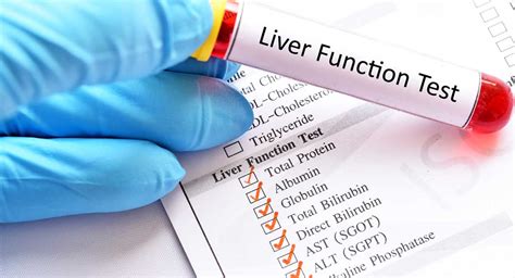 Liver Function Tests - Understanding Your Blood Test Results - Dr ...