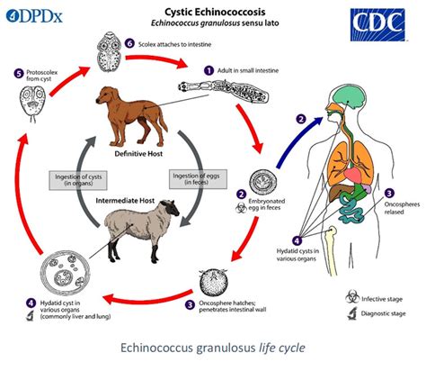 Echinococcosis | LDBIO Diagnostics