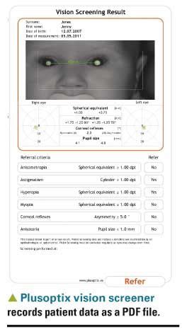 Taille relative à chaque fois Antécédent spot vision screener results ...