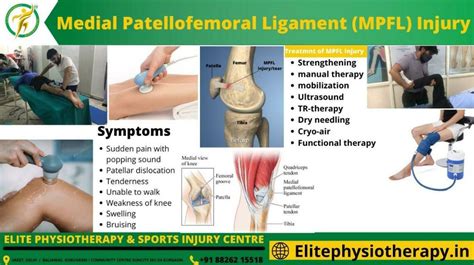 Medialpatellofemoral Ligament (Mpfl) Injury