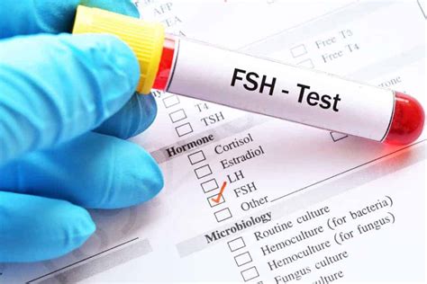 Follicle Stimulating Hormone (FSH) - Coast to Coast Compounding