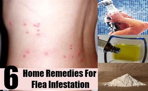 Know How to Get Rid of Fleas in the House | Home remedies for fleas ...