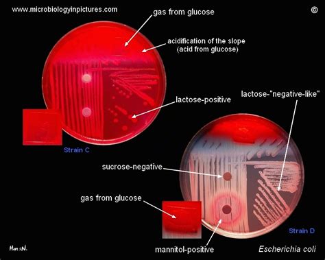 Batteri E.coli a lattosio ritardato. I fermentatori di lattosio ...