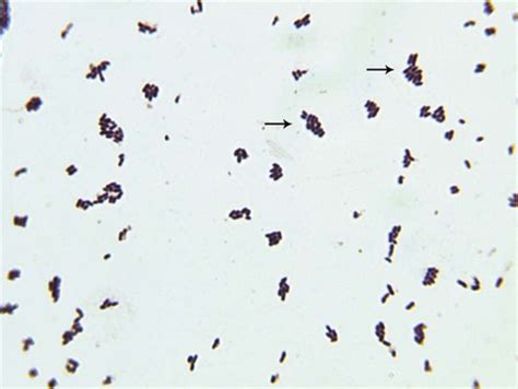 Corynebacterium Gram Stain Morphology