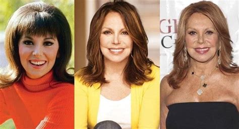 Marlo Thomas Plastic Surgery: Before & After Transformations ...