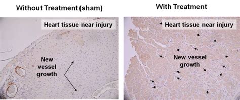 Endonovo Therapeutics – Angiogenesis Heart