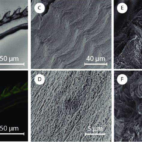 (A) Optical and (B) fluorescence microscope images of a radula ...