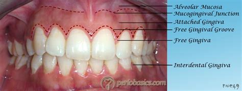 Marginal Gingiva