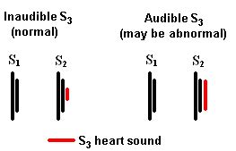 S3 Heart Sound Topic Review | Learn the Heart