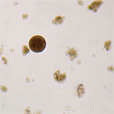 Entamoeba coli Trophozoites, smear Microscope Slide | Carolina.com