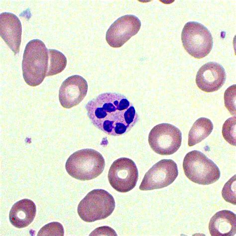 Neutrophils | Blood Film - MedSchool