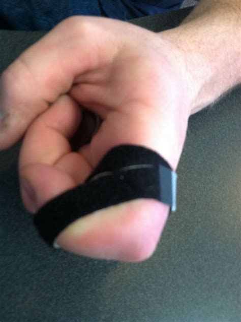 FInger flexion strap, used for brief periods to improve PIP, DIP ...