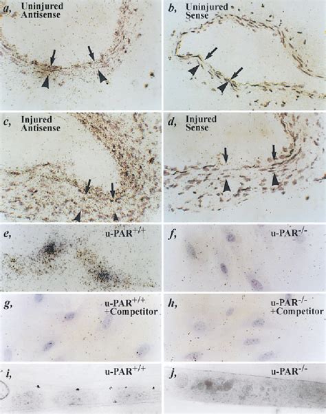 Figure 5 from Receptor-independent Role of Urokinase-Type Plasminogen ...