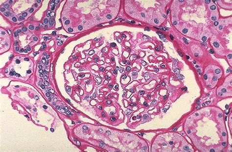 Glomerular Basement Membrane Histology