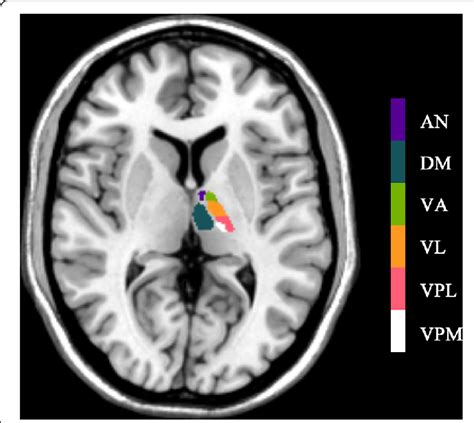 The standard thalamic subnuclei templates were created according to ...