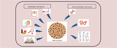 Osteoporosis: Risk factors, diagnosis, and treatment - Lilyfield ...