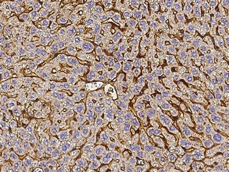 Vitronectin Antibody (MA5-29842)