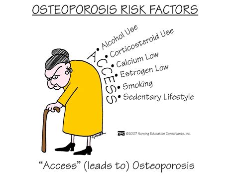 Osteoporosis Risk Factors – ONESTOPNURSING | Medical surgical nursing ...