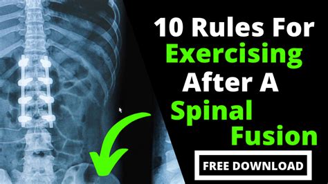 Top 10 Core Exercises Safe For Spinal Fusions - Fitness 4 Back Pain