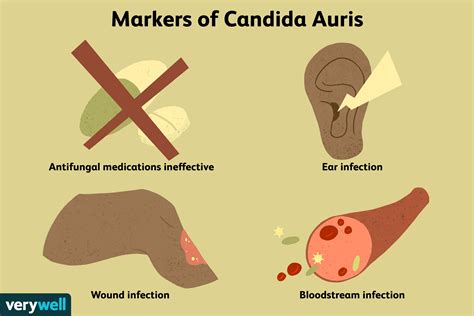 Candida Auris คืออะไร? - MedThai