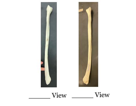 Fibula Quiz