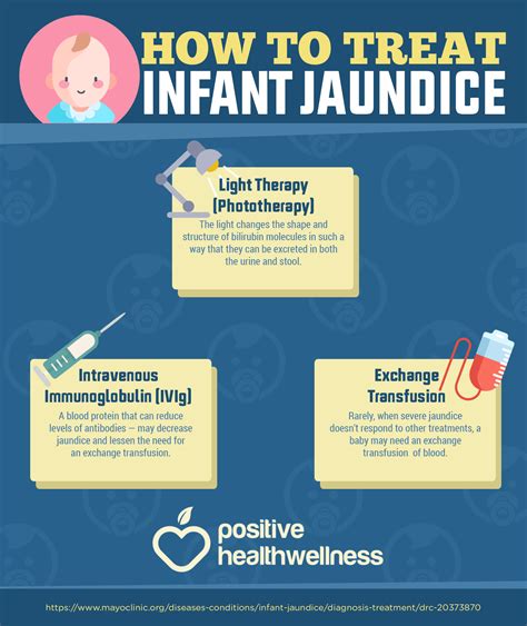 How to Treat Infant Jaundice – Infographic – Positive Health Wellness