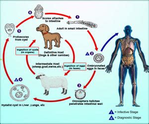 Hydatid Cyst / Hydatid Disease - Causes, Symptoms, Diagnosis, Treatment ...