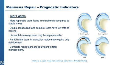 3 Types of Meniscus Tear Treatment | Knee Specialist | Baton Rouge, LA