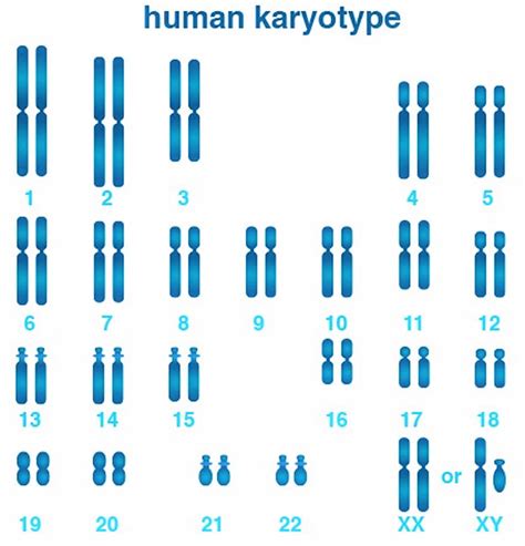 Karyotype, karyotype test & analysis, normal karyotype & abnormal karyotype