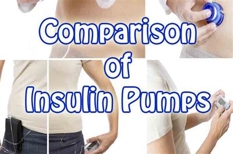 Comparison of Insulin Pumps