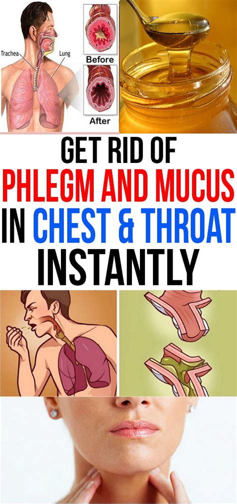 Get Rid of Phlegm and Mucus in Chest & Throat Instantly - Healthy Lifestyle