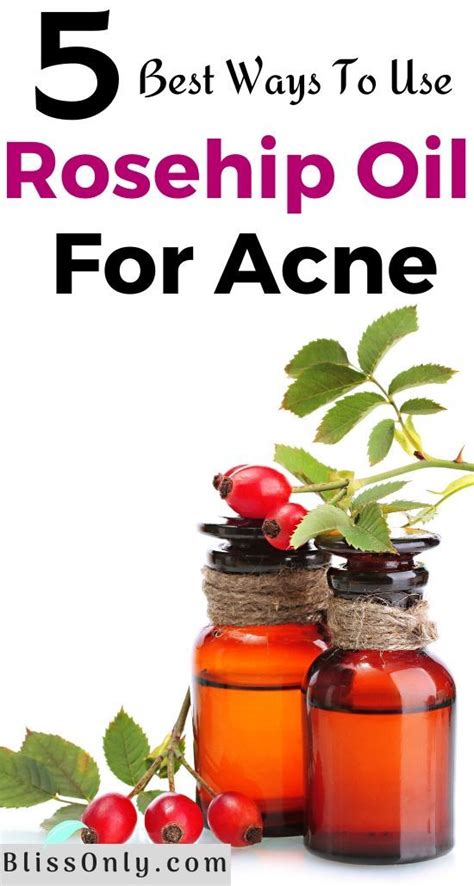 Rosehip oil for acne is one of the home remedies to get healthy and ...