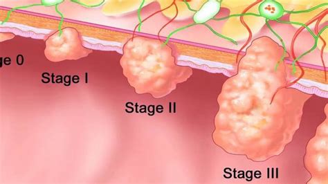 What Is The Colon? — Gupta Gastro