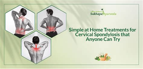 Simple at Home Treatments For Cervical Spondylosis that Anyone Can Try