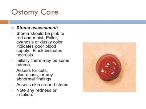 healthy stoma Gallery | Ostomy care, Stoma, Ostomy