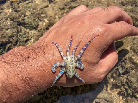 Blue-Ringed Octopus Bite Symptoms and Emergency First Aid