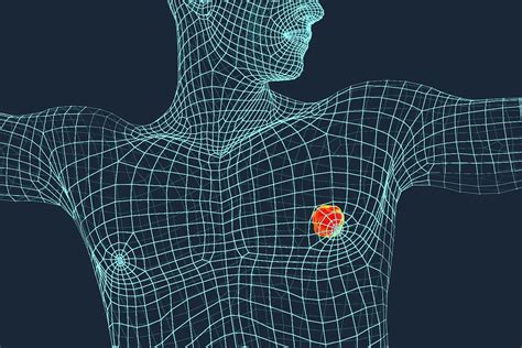 Visual Guide to Male Breast Cancer