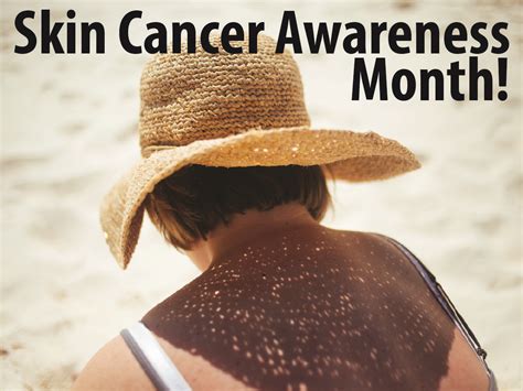 The OACHC Informer: Skin Cancer Prevention