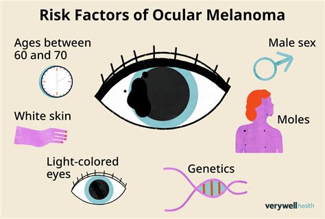 Eye Melanoma: Symptoms and Prognosis of Eye Cancer