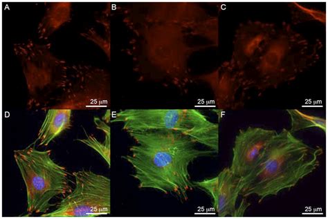 Paxillin expression and localization in osteoblasts. (A–C) Paxillin ...