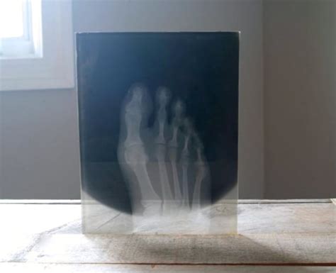 Antique X Ray on Glass of Foot Antique Medical X Ray by 5gardenias